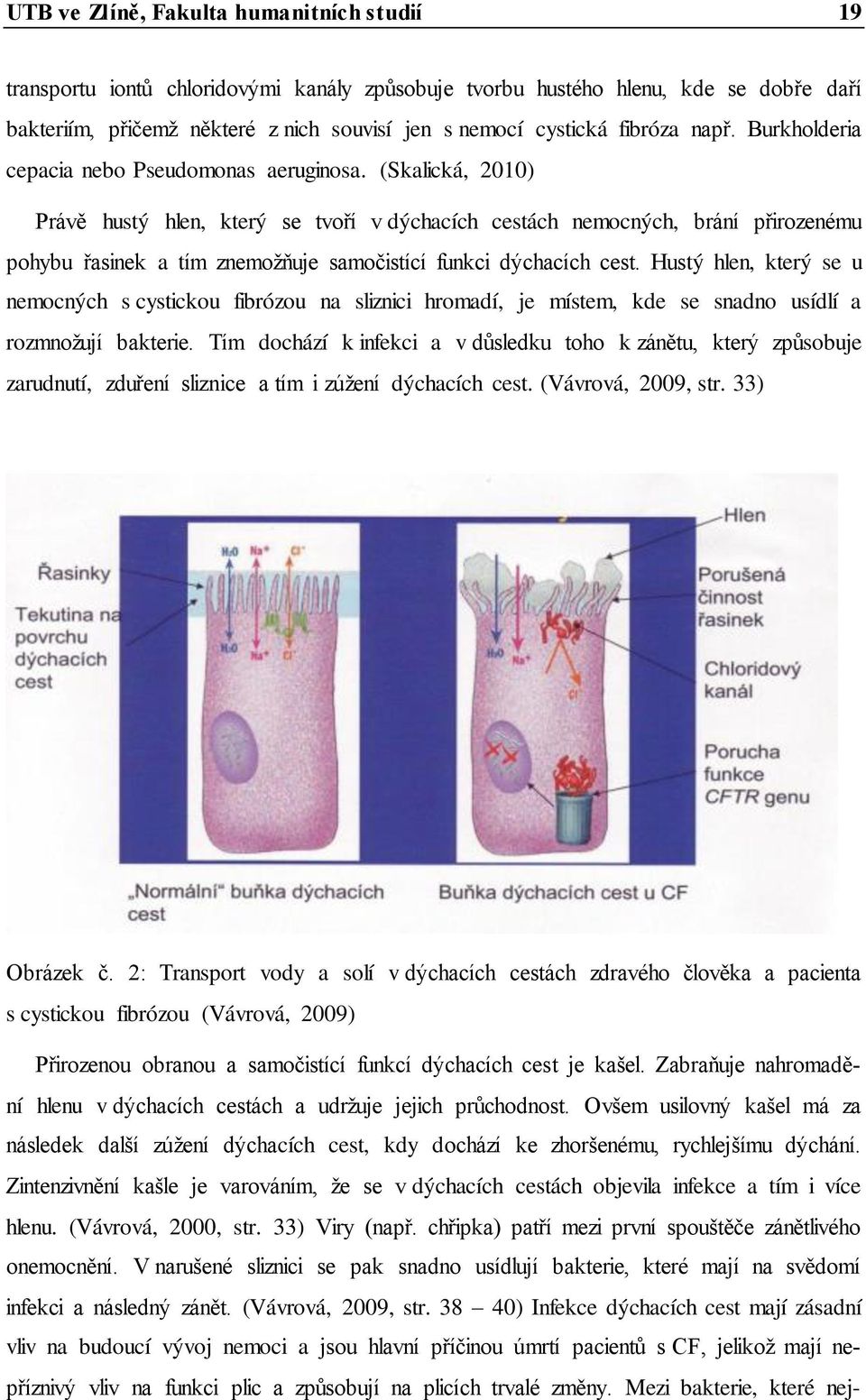 (Skalická, 2010) Právě hustý hlen, který se tvoří v dýchacích cestách nemocných, brání přirozenému pohybu řasinek a tím znemožňuje samočistící funkci dýchacích cest.