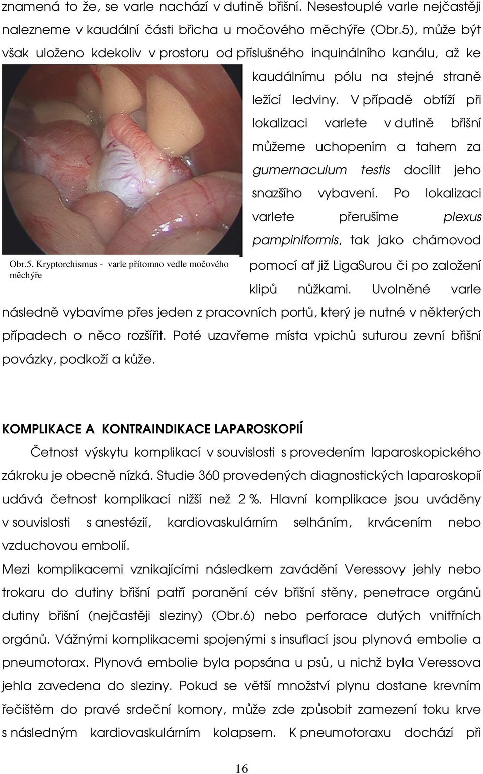 V případě obtíží při lokalizaci varlete v dutině břišní můžeme uchopením a tahem za gumernaculum testis docílit jeho snazšího vybavení.