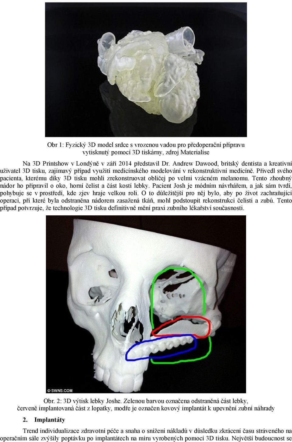 Přivedl svého pacienta, kterému díky 3D tisku mohli zrekonstruovat obličej po velmi vzácném melanomu. Tento zhoubný nádor ho připravil o oko, horní čelist a část kostí lebky.