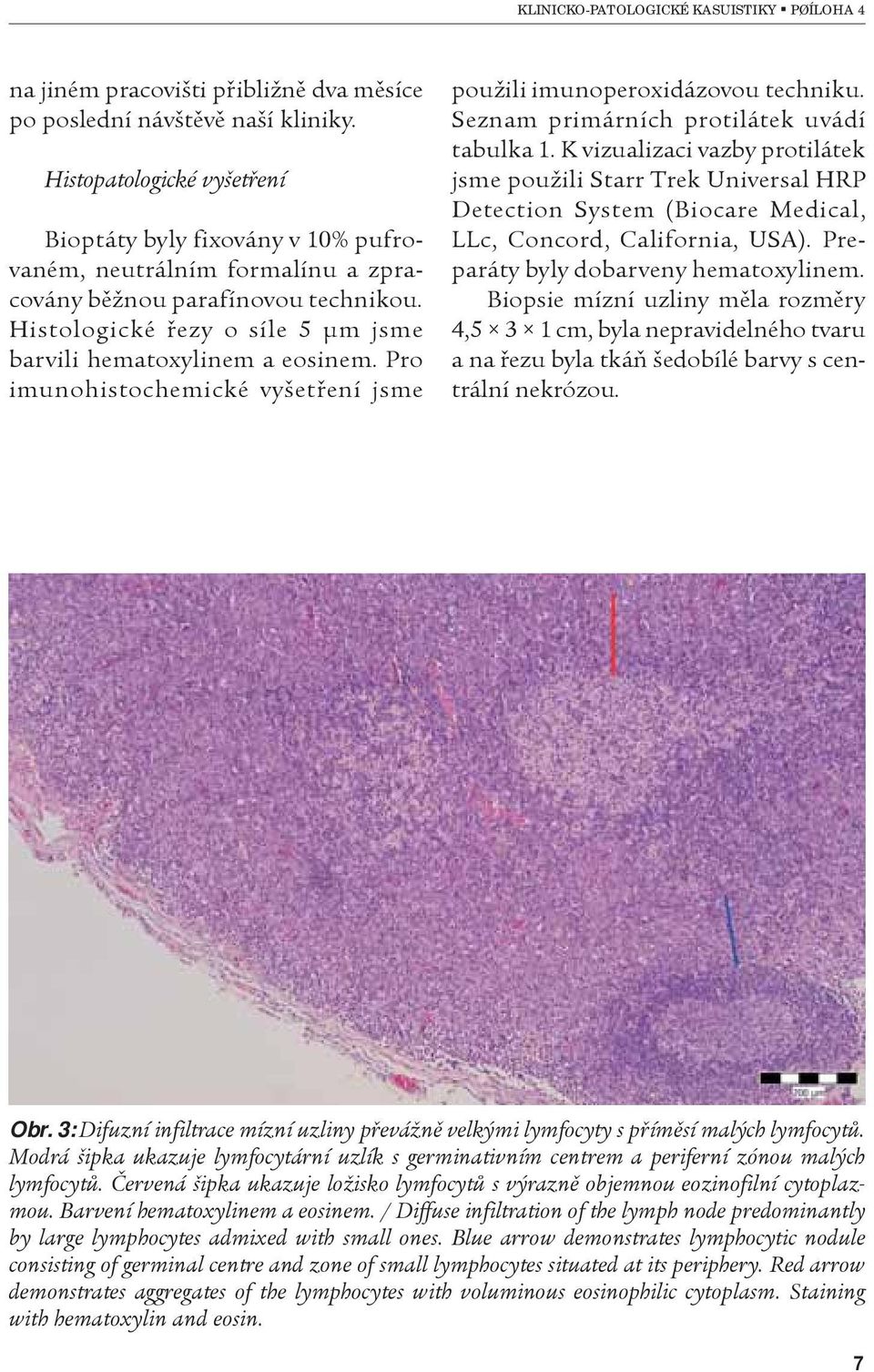 Pro imunohistochemické vyšetøení jsme použili imunoperoxidázovou techniku. Seznam primárních protilátek uvádí tabulka 1.
