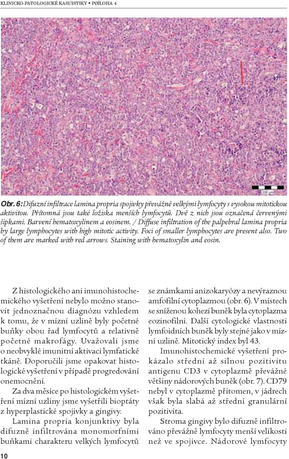 Two of them are marked with red arrows. Staining with hematoxylin and eosin.