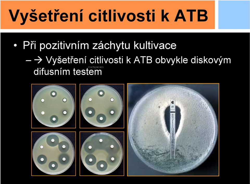 Vyšetření citlivosti k ATB