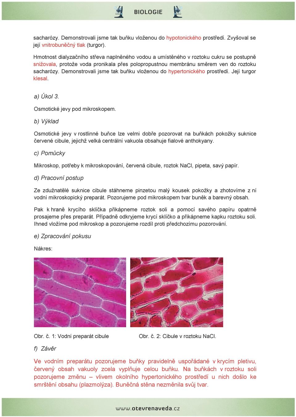 Demonstrovali jsme tak buňku vloženou do hypertonického prostředí. Její turgor klesal. a) Úkol 3. Osmotické jevy pod mikroskopem.