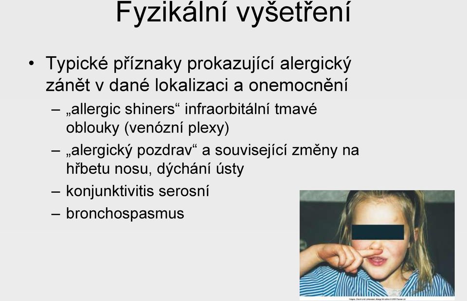 tmavé oblouky (venózní plexy) alergický pozdrav a související