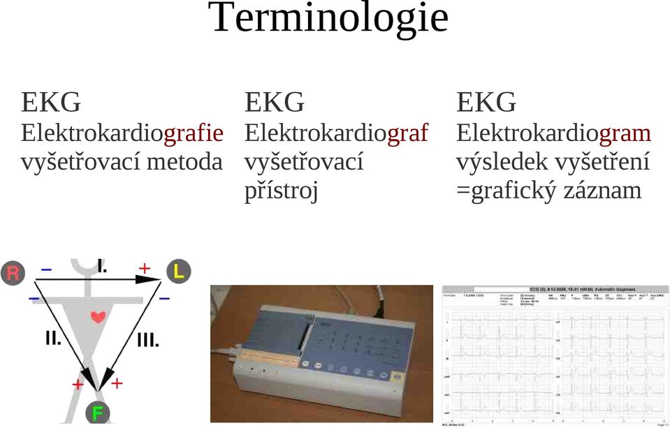 Elektrokardiograf vyšetřovací přístroj