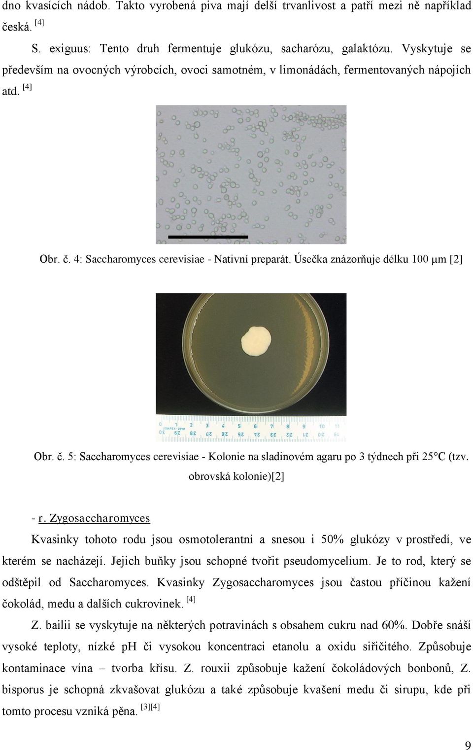 Úsečka znázorňuje délku 100 µm [2] Obr. č. 5: Saccharomyces cerevisiae - Kolonie na sladinovém agaru po 3 týdnech při 25 C (tzv. obrovská kolonie)[2] - r.