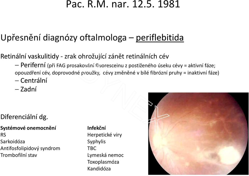 proužky, cévy změněné v bílé fibrózní pruhy = inaktivní fáze) Centrální Zadní Diferenciální dg.