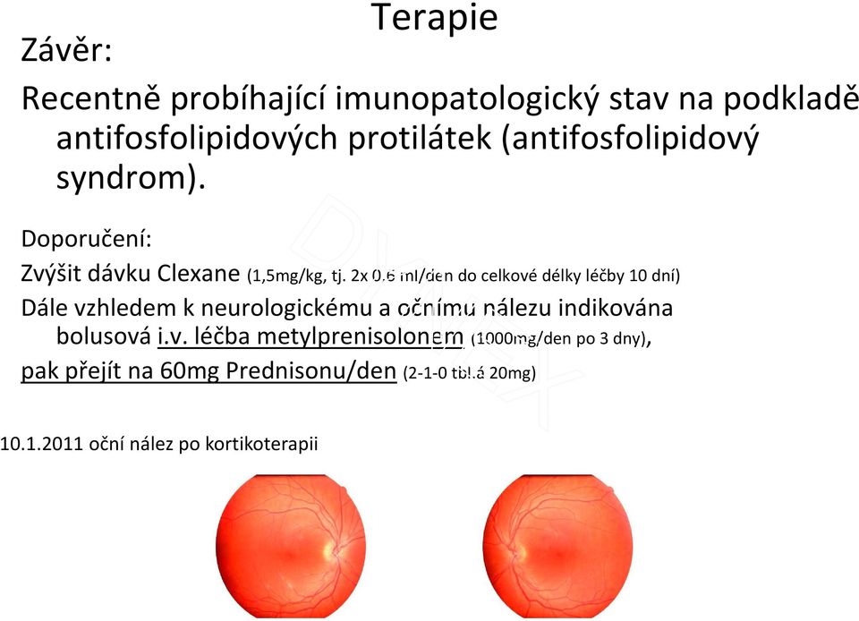 2x 0,6 ml/den do celkové délky léčby 10 dní) Dále vzhledem k neurologickému a očnímu nálezu indikována