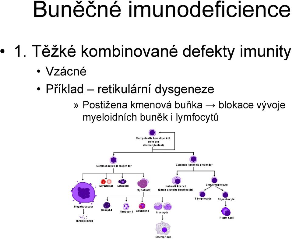 Příklad retikulární dysgeneze» Postižena