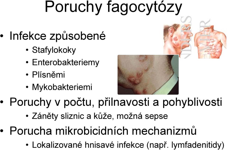 přilnavosti a pohyblivosti Záněty sliznic a kůže, možná sepse