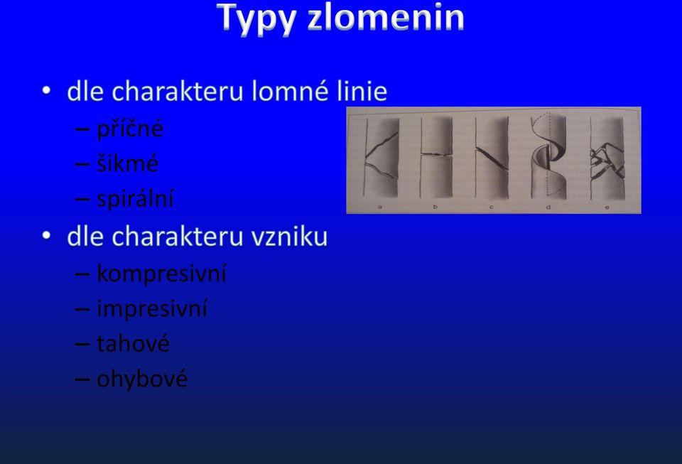 kompresivní