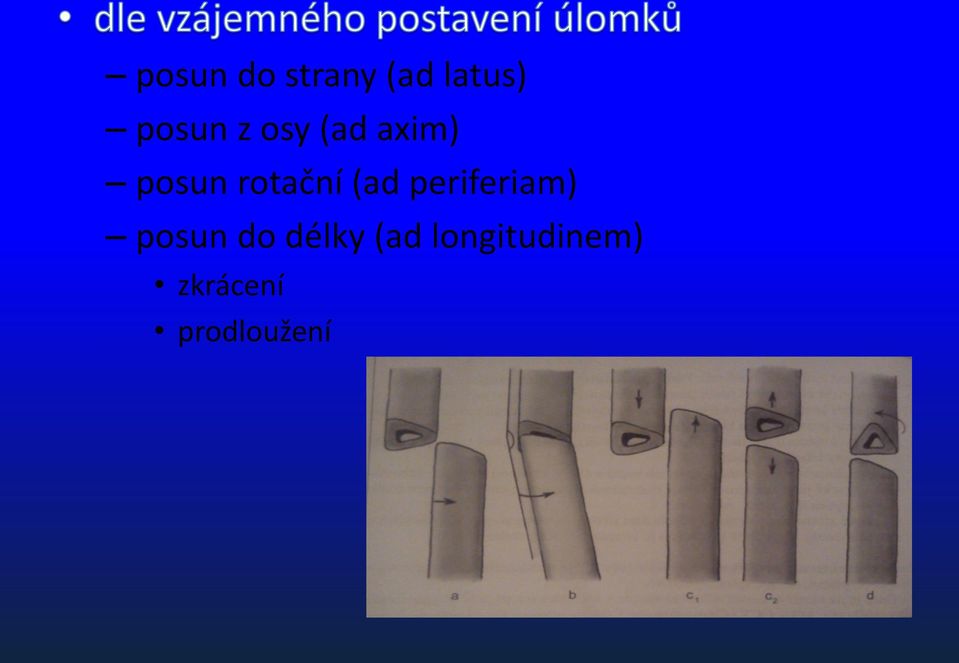 (ad periferiam) posun do délky