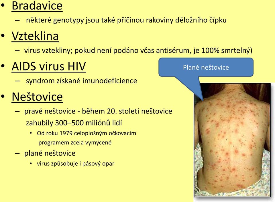 Neštovice pravé neštovice - během 20.