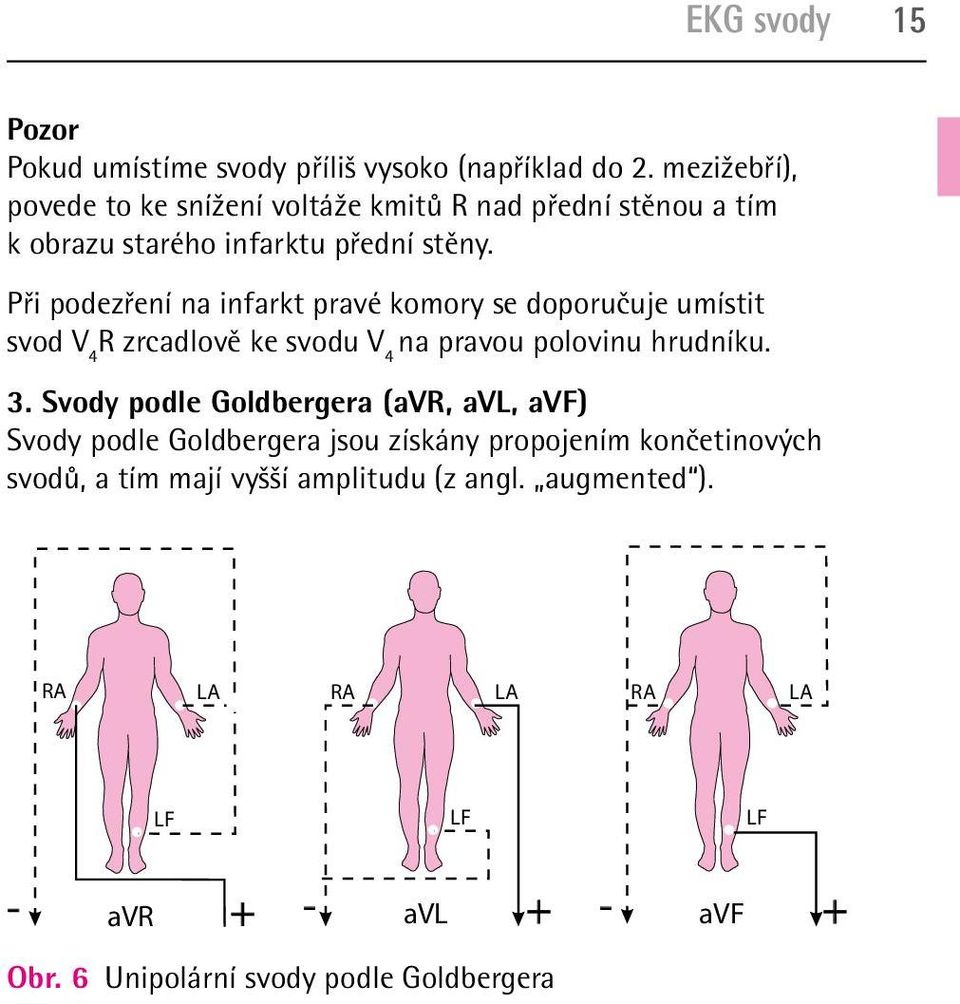 Při podezření na infarkt pravé komory se doporučuje umístit svod V 4 R zrcadlově ke svodu V 4 na pravou polovinu hrudníku. 3.