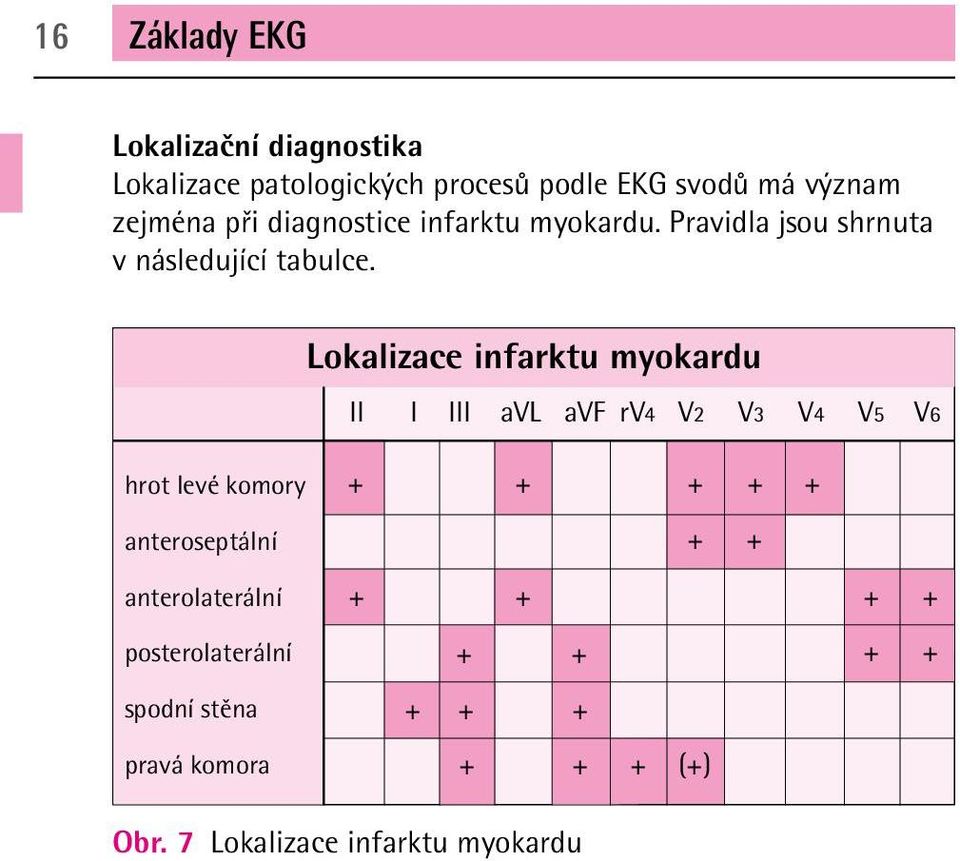 Lokalizace infarktu myokardu II I III avl avf rv4 V2 V3 V4 V5 V6 hrot levé komory