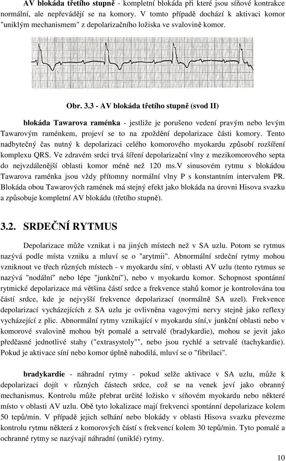 3 - AV blokáda třetího stupně (svod II) blokáda Tawarova raménka - jestliže je porušeno vedení pravým nebo levým Tawarovým raménkem, projeví se to na zpoždění depolarizace části komory.