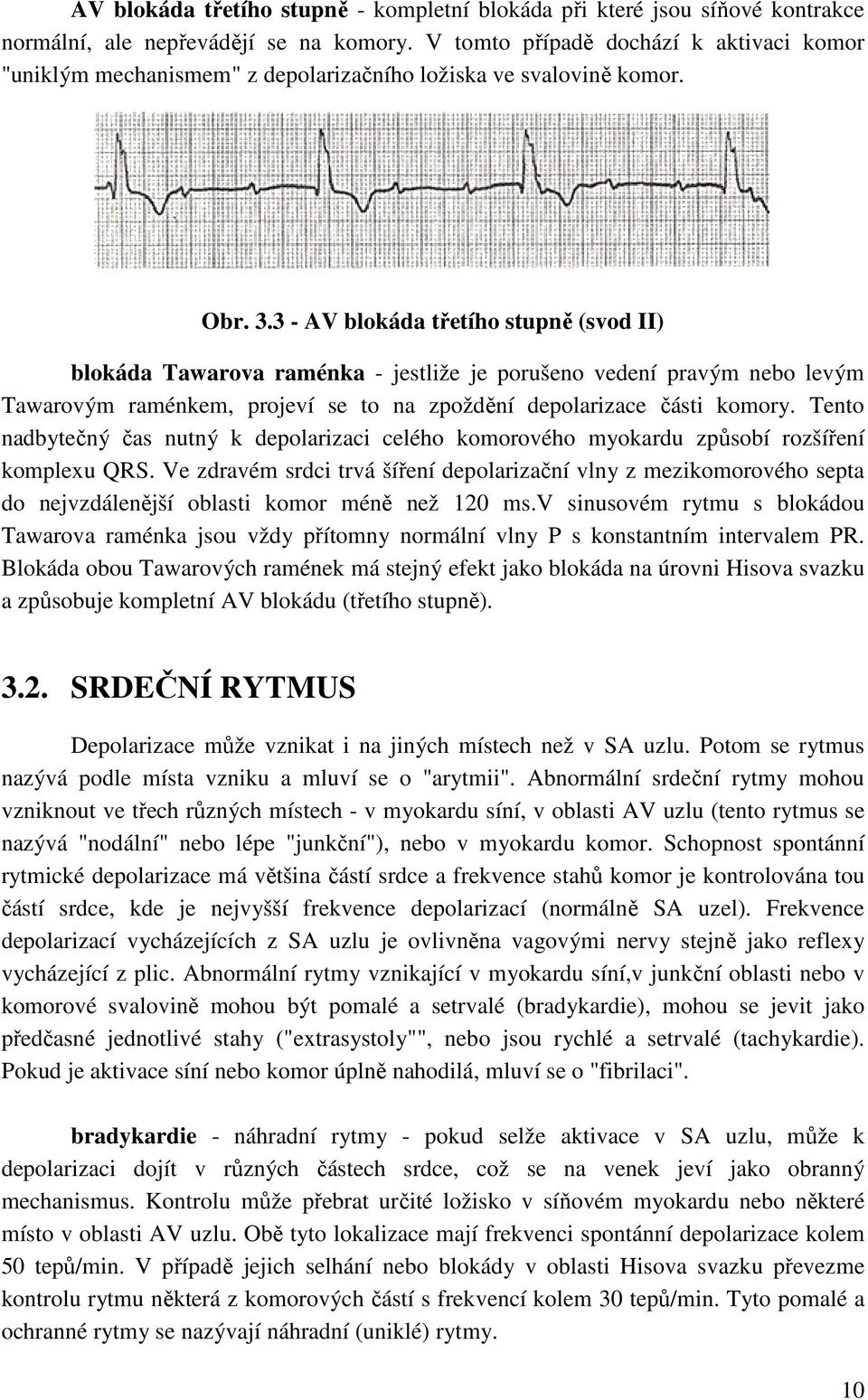 3 - AV blokáda třetího stupně (svod II) blokáda Tawarova raménka - jestliže je porušeno vedení pravým nebo levým Tawarovým raménkem, projeví se to na zpoždění depolarizace části komory.