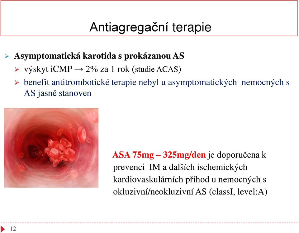jasně stanoven ASA 75mg 325mg/den je doporučena k prevenci IM a dalších ischemických