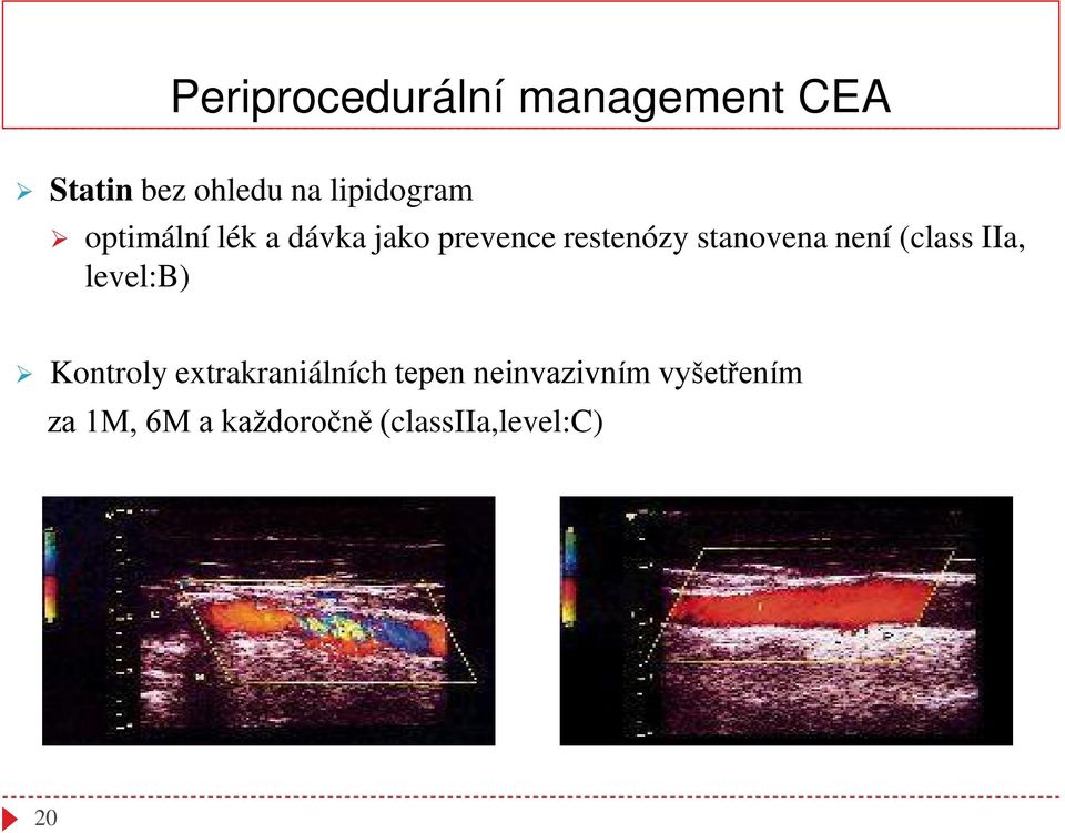 stanovena není (class IIa, level:b) Kontroly extrakraniálních