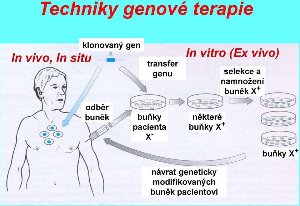 buněk X + odběr buněk buňky pacienta X - některé buňky X