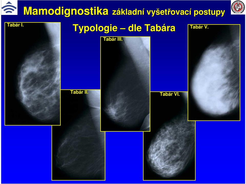 vyšet Typologie dle Tabára