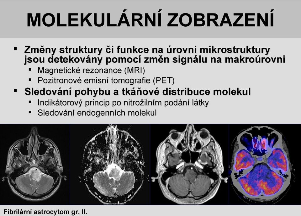 molekul Indikátorový princip po nitrožilním podání látky Sledování endogenních molekul Možnosti molekulárního