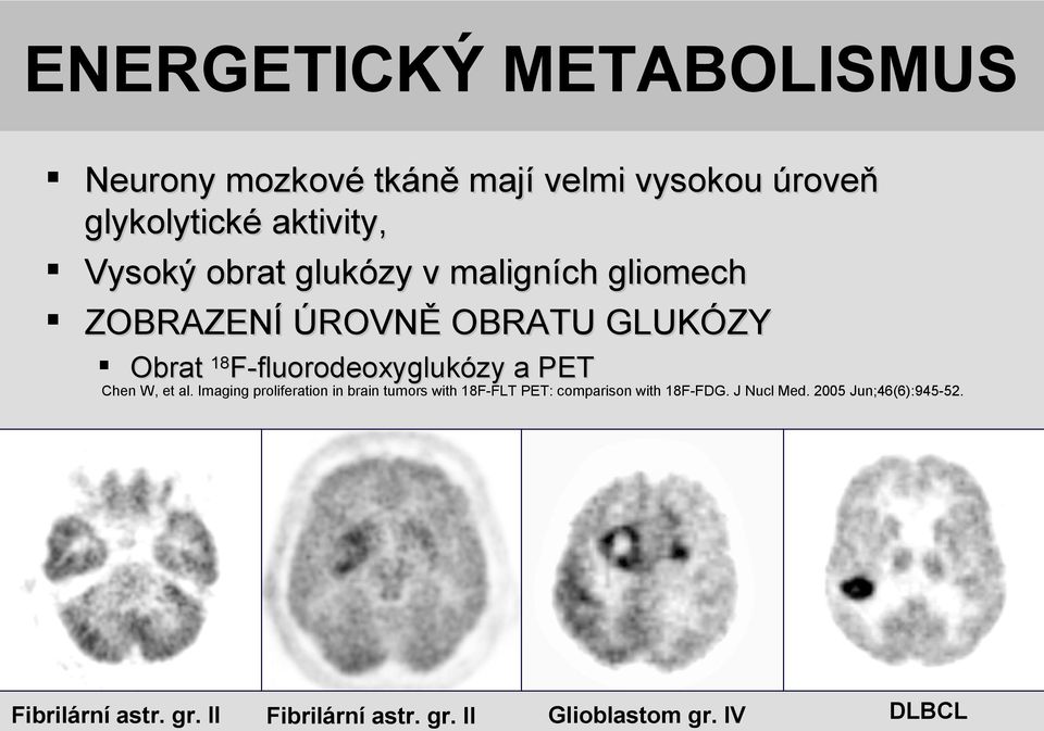 18F-fluorodeoxyglukózy a PET Chen W, et al.