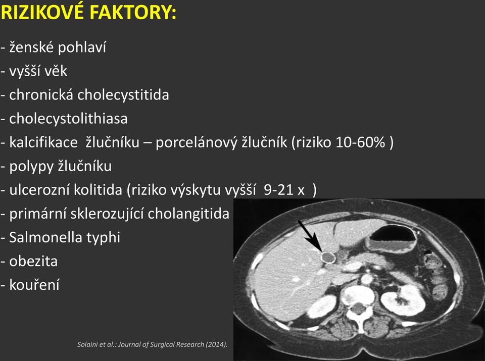 žlučníku - ulcerozní kolitida (riziko výskytu vyšší 9-21 x ) - primární sklerozující