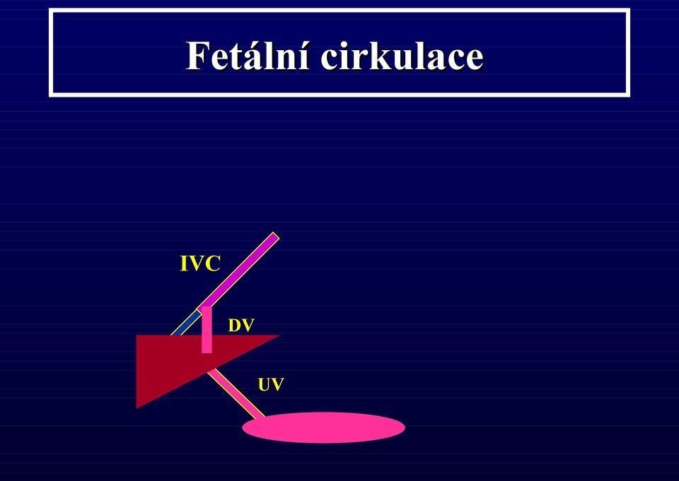 IVC DV UV