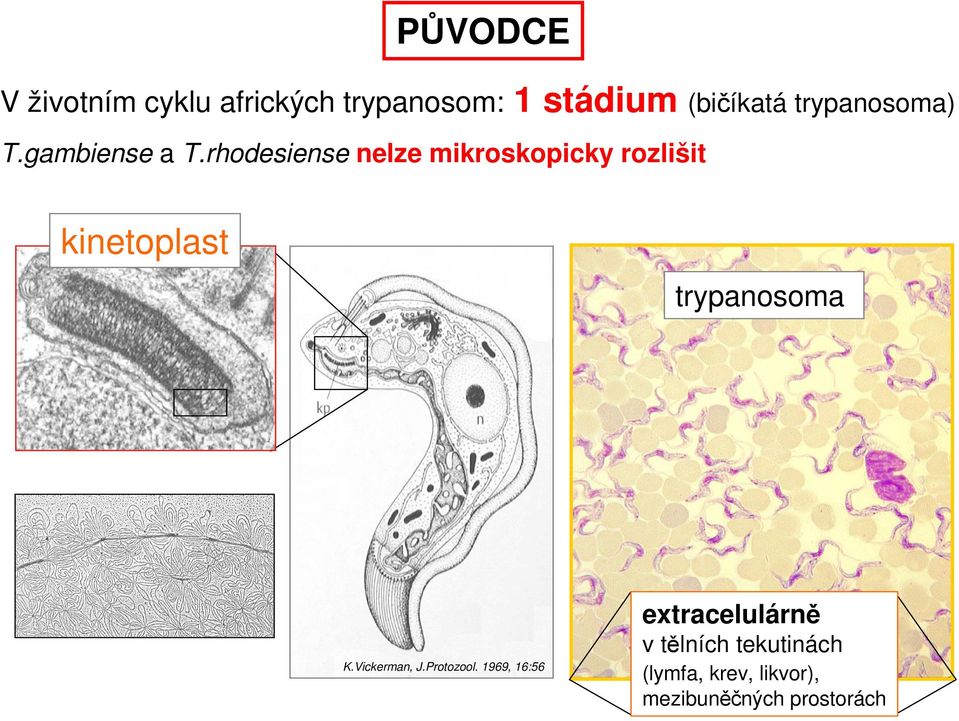 rhodesiense nelze mikroskopicky rozlišit kinetoplast trypanosoma K.