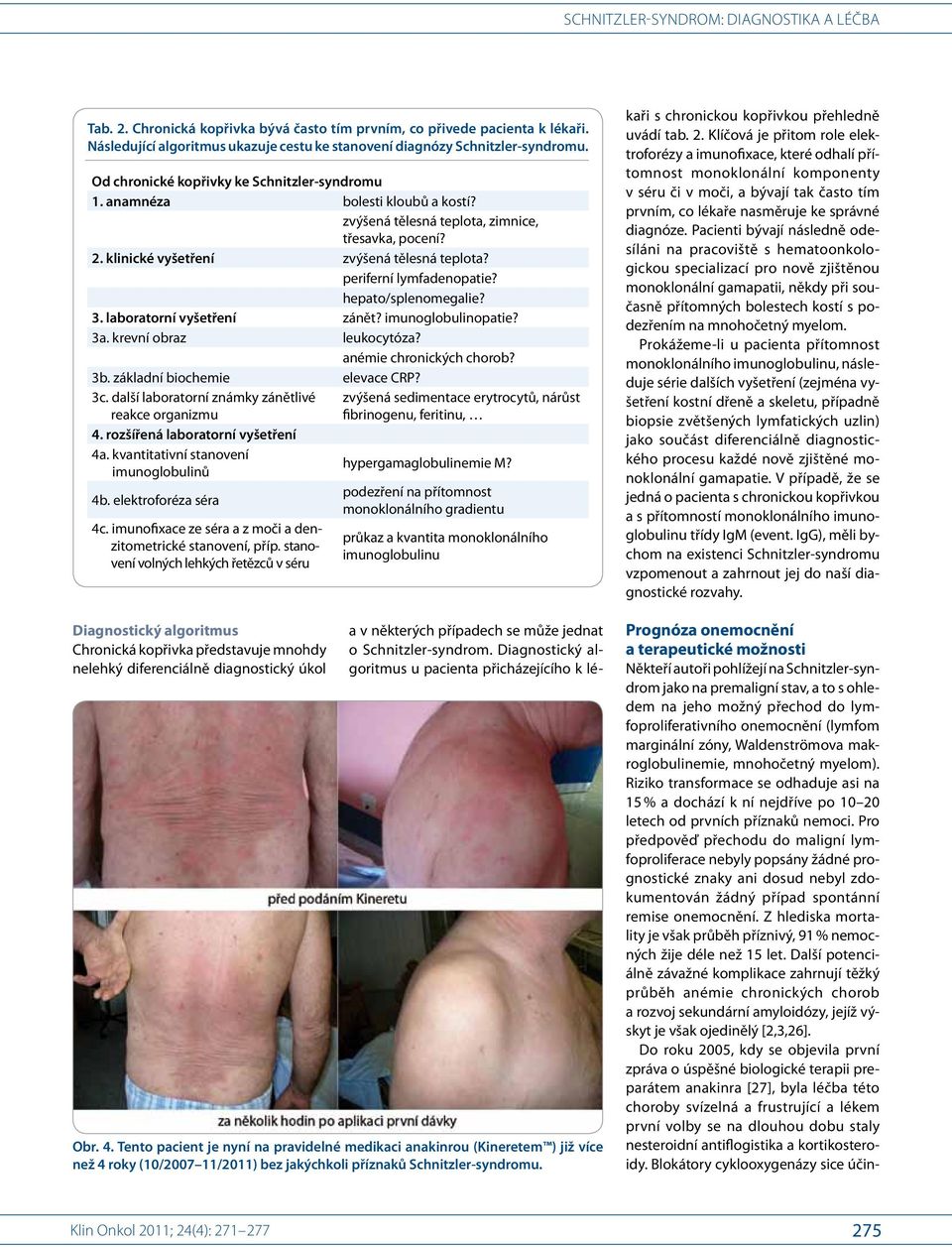 periferní lymfadenopatie? hepato/splenomegalie? 3. laboratorní vyšetření zánět? imunoglobulinopatie? 3a. krevní obraz leukocytóza? anémie chronických chorob? 3b. základní biochemie elevace CRP? 3c.