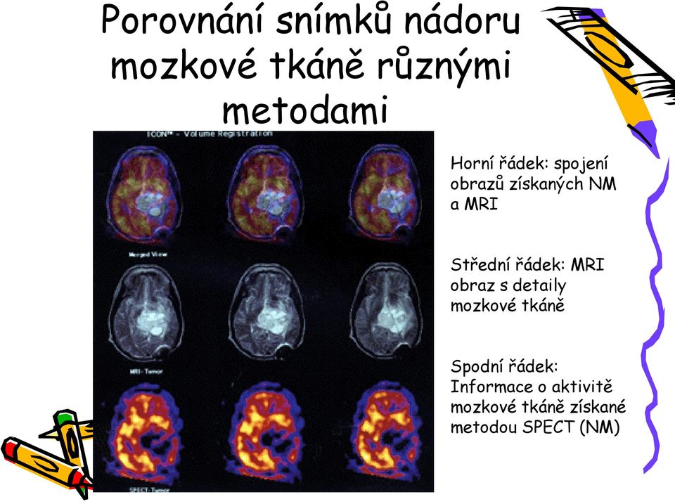 řádek: MRI obraz s detaily mozkové tkáně Spodní řádek: