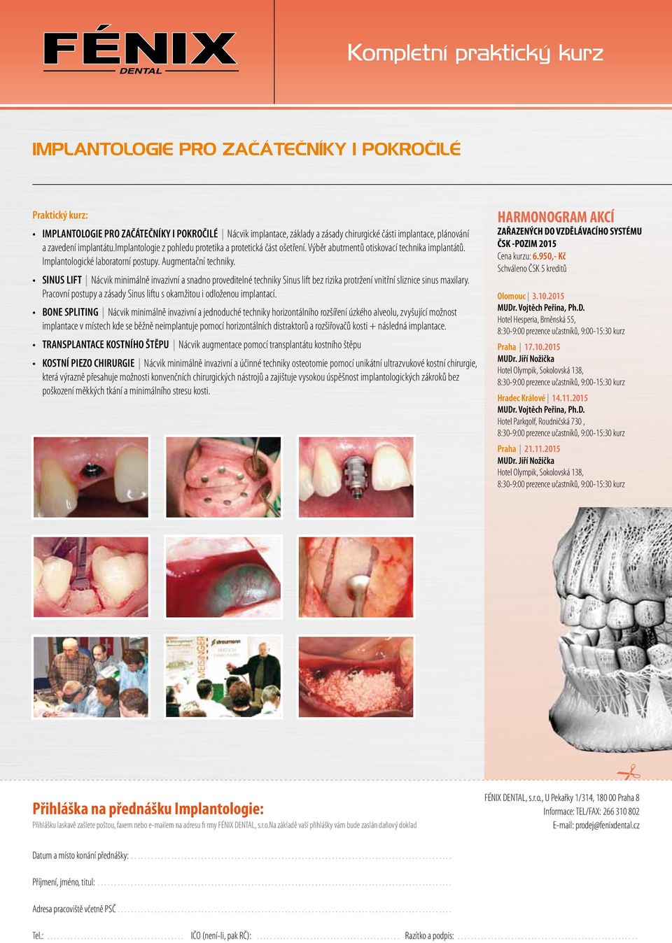 SINUS LIFT Nácvik minimálně invazivní a snadno proveditelné techniky Sinus lift bez rizika protržení vnitřní sliznice sinus maxilary.