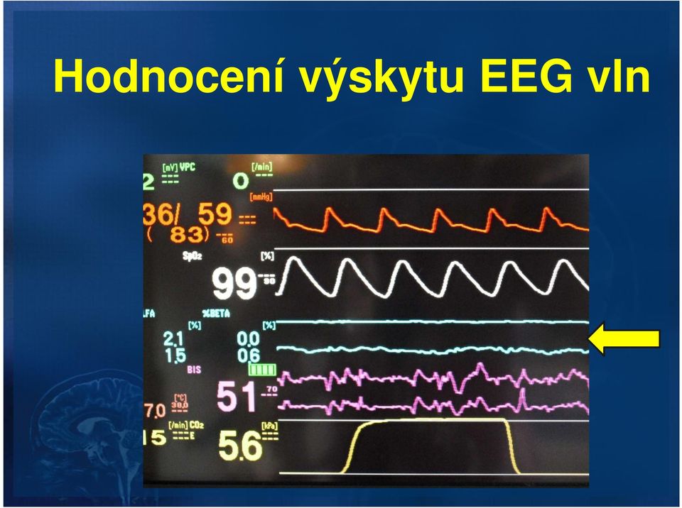 EEG vln