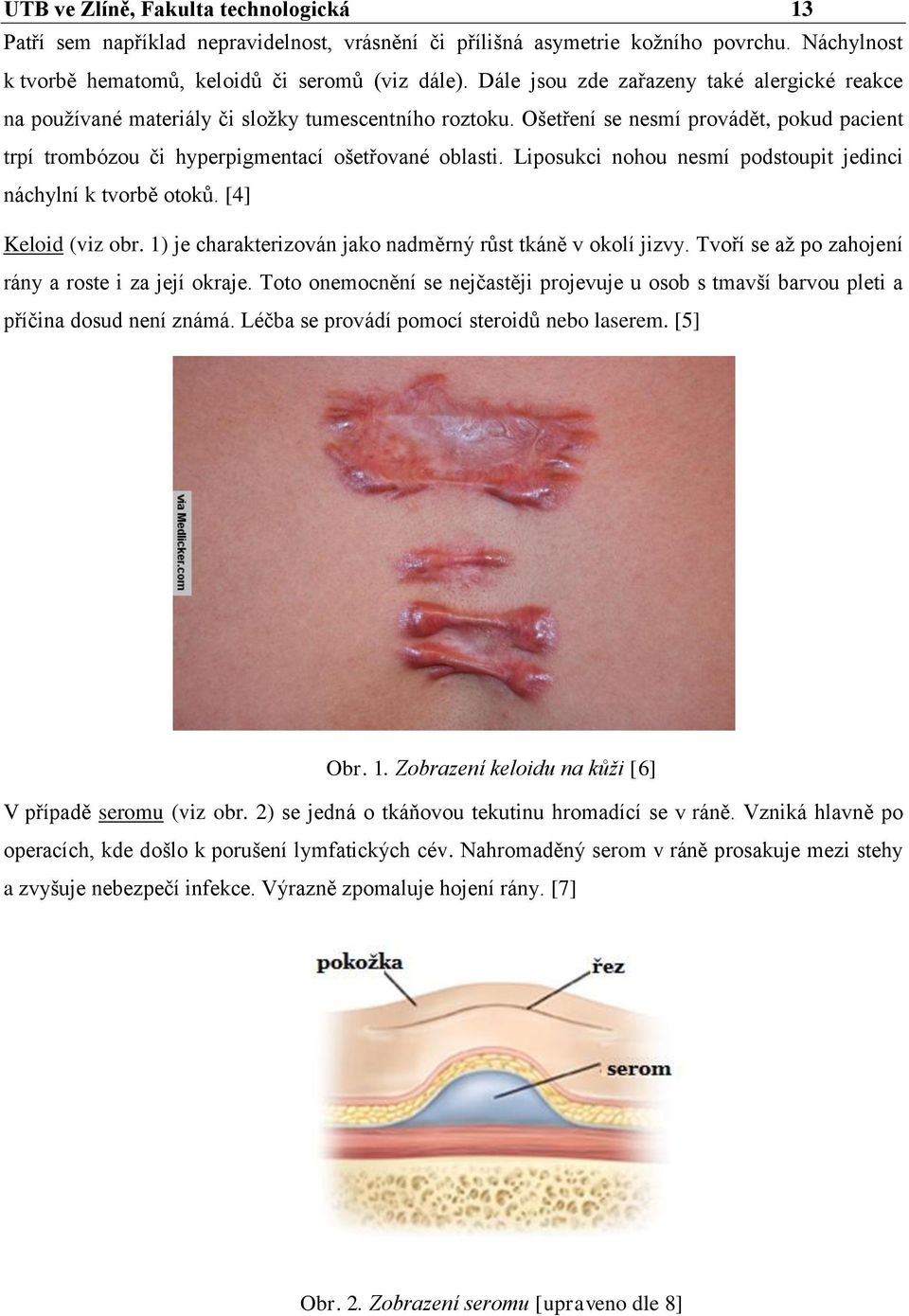 Liposukci nohou nesmí podstoupit jedinci náchylní k tvorbě otoků. [4] Keloid (viz obr. 1) je charakterizován jako nadměrný růst tkáně v okolí jizvy.