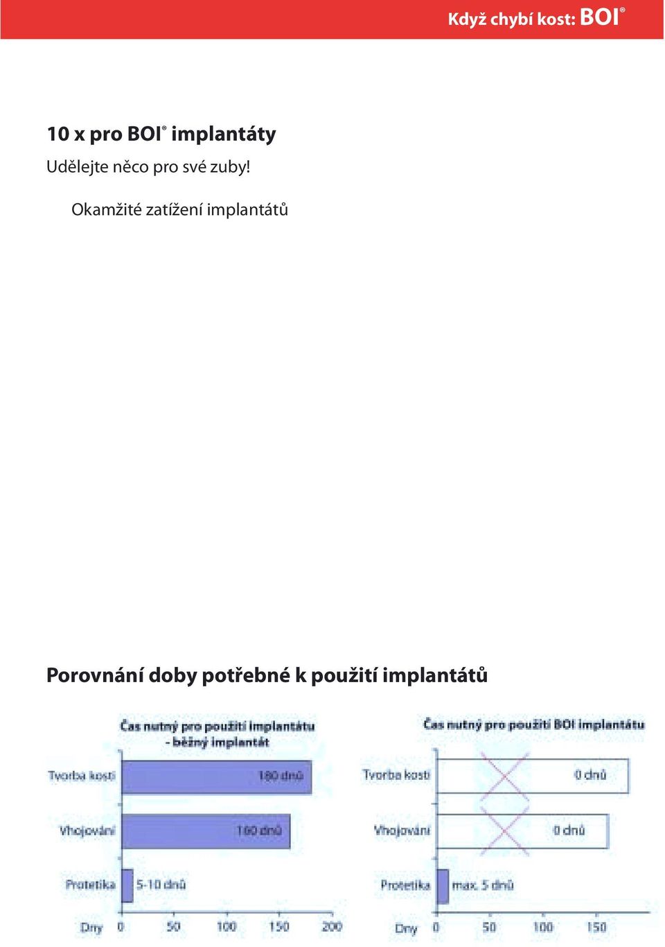 zhotovení zubů Implantace možná bezprostředně po vytažení viklavých zubů Tvar implantátu umožňuje optimální výživu čelistní kosti Rychlost