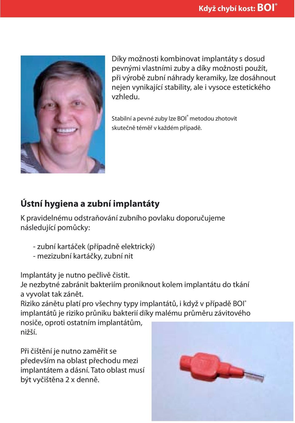 Ústní hygiena a zubní implantáty K pravidelnému odstraňování zubního povlaku doporučujeme následující pomůcky: - zubní kartáček (případně elektrický) - mezizubní kartáčky, zubní nit Implantáty je