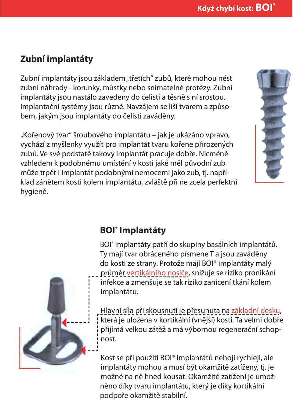 Kořenový tvar šroubového implantátu jak je ukázáno vpravo, vychází z myšlenky využít pro implantát tvaru kořene přirozených zubů. Ve své podstatě takový implantát pracuje dobře.