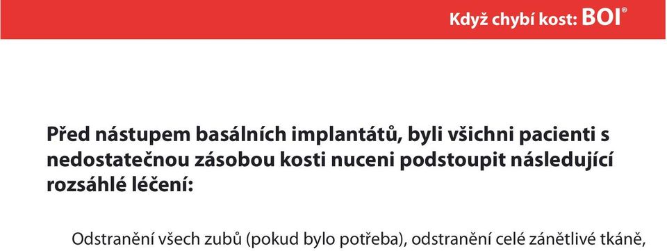 Zvětšení kosti, možné až za 2 měsíce (s možným špatným zhojením či nevhojením přidané části kosti), následované 6 měsíčním čekacím obdobím Zavedení šroubových implantátů a čekání na jejich vhojení Na