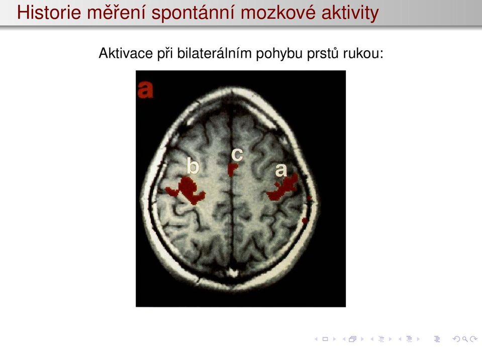 aktivity Aktivace při