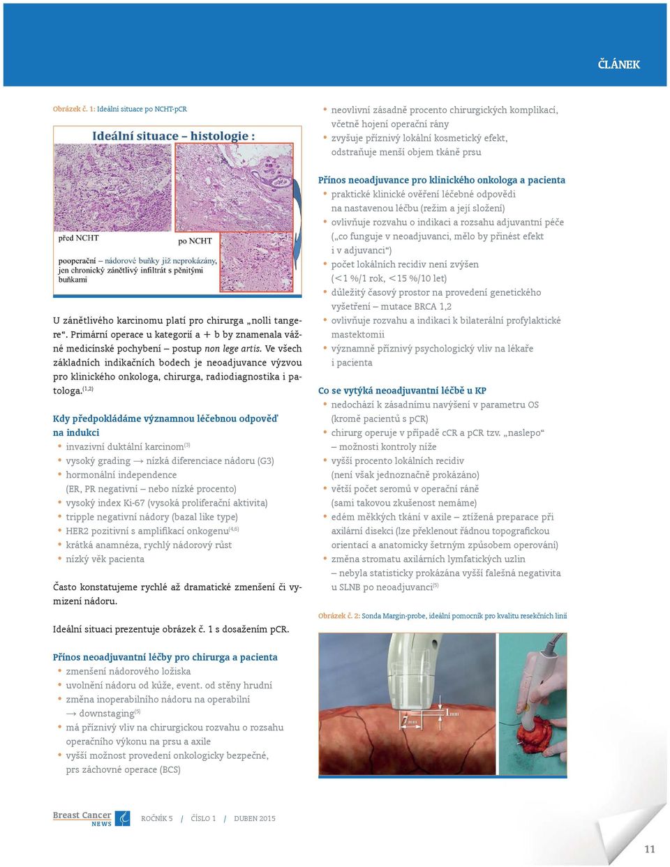 zánětlivého karcinomu platí pro chirurga nolli tangere. Primární operace u kategorií a + b by znamenala vážné medicínské pochybení postup non lege artis.