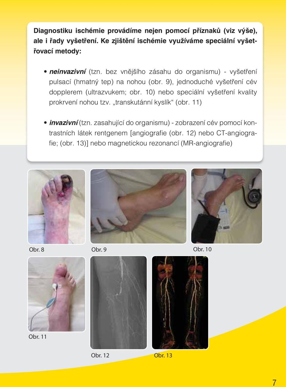 bez vnějšího zásahu do organismu) - vyšetření pulsací (hmatný tep) na nohou (obr. 9), jednoduché vyšetření cév dopplerem (ultrazvukem; obr.