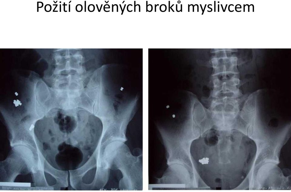 broků