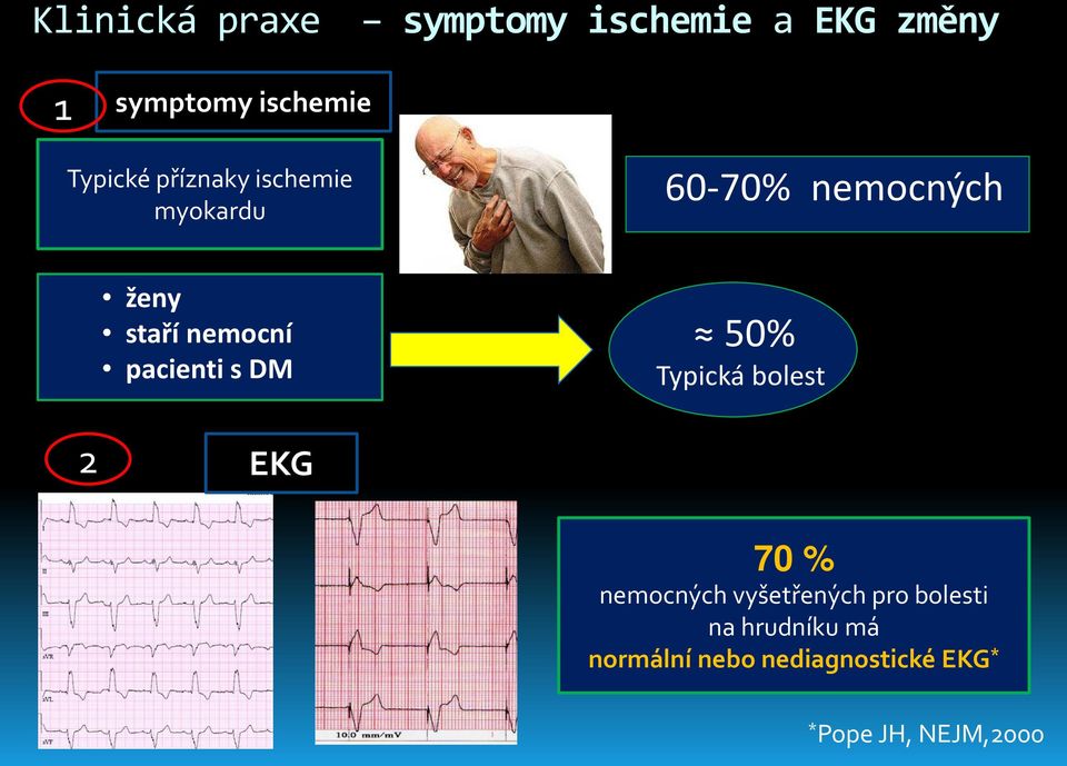 pacienti s DM 50% Typická bolest 2 EKG 70 % nemocných vyšetřených pro