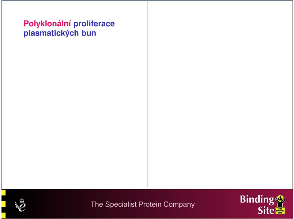 plasmatických buněk Zvýšená produkce obou FLC Zvýšená produkce