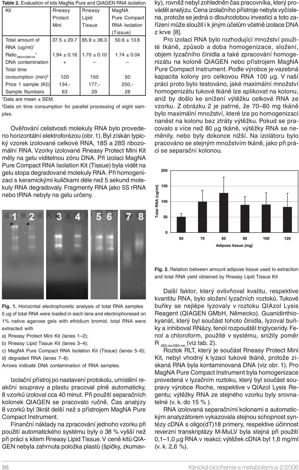 2 Data on time consumption for parallel processing of eight samples. Ověřování celistvosti molekuly RNA bylo provedeno horizontální elektroforézou (obr. 1).