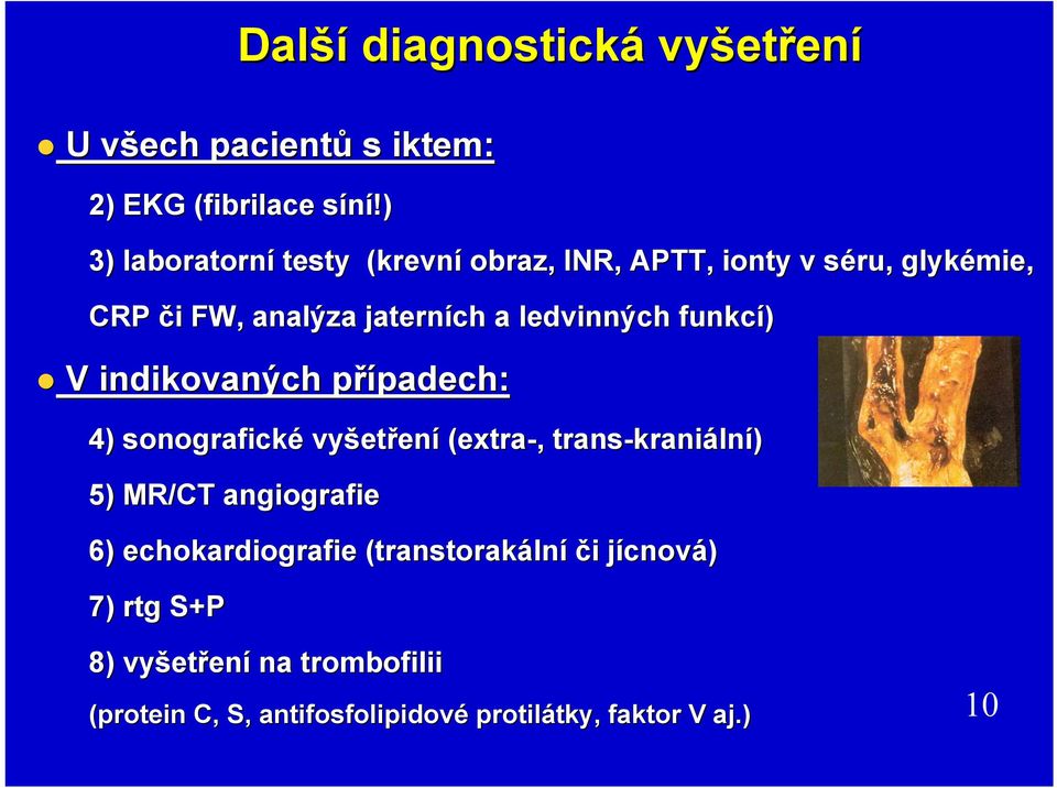 ledvinných funkcí) V indikovaných případech: p padech: 4) sonografické vyšet etření (extra-,, trans-krani kraniální) 5) MR/CT