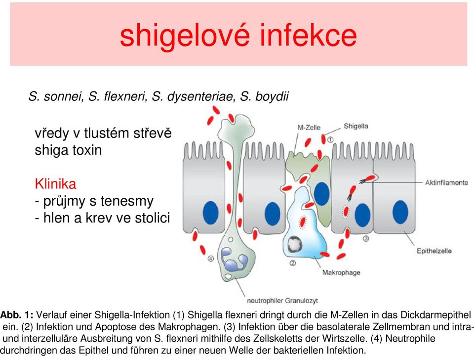 : Verlauf einer Shigella-Infektion () Shigella flexneri dringt durch die M-Zellen in das Dickdarmepithel ein.