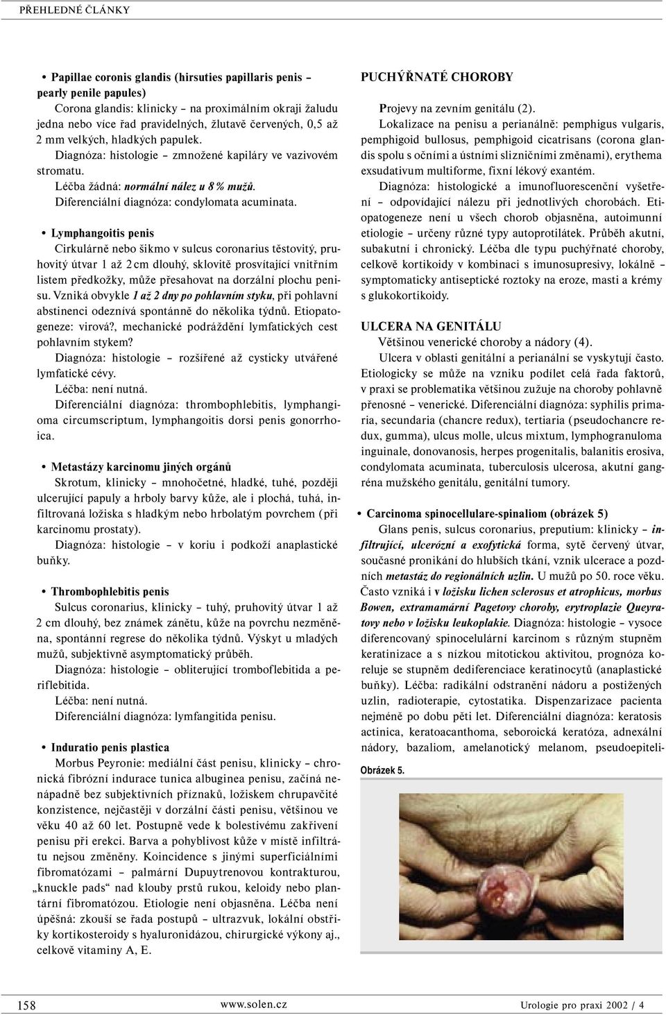Lymphangoitis penis Cirkulárně nebo šikmo v sulcus coronarius těstovitý, pruhovitý útvar 1 až 2 cm dlouhý, sklovitě prosvítající vnitřním listem předkožky, může přesahovat na dorzální plochu penisu.