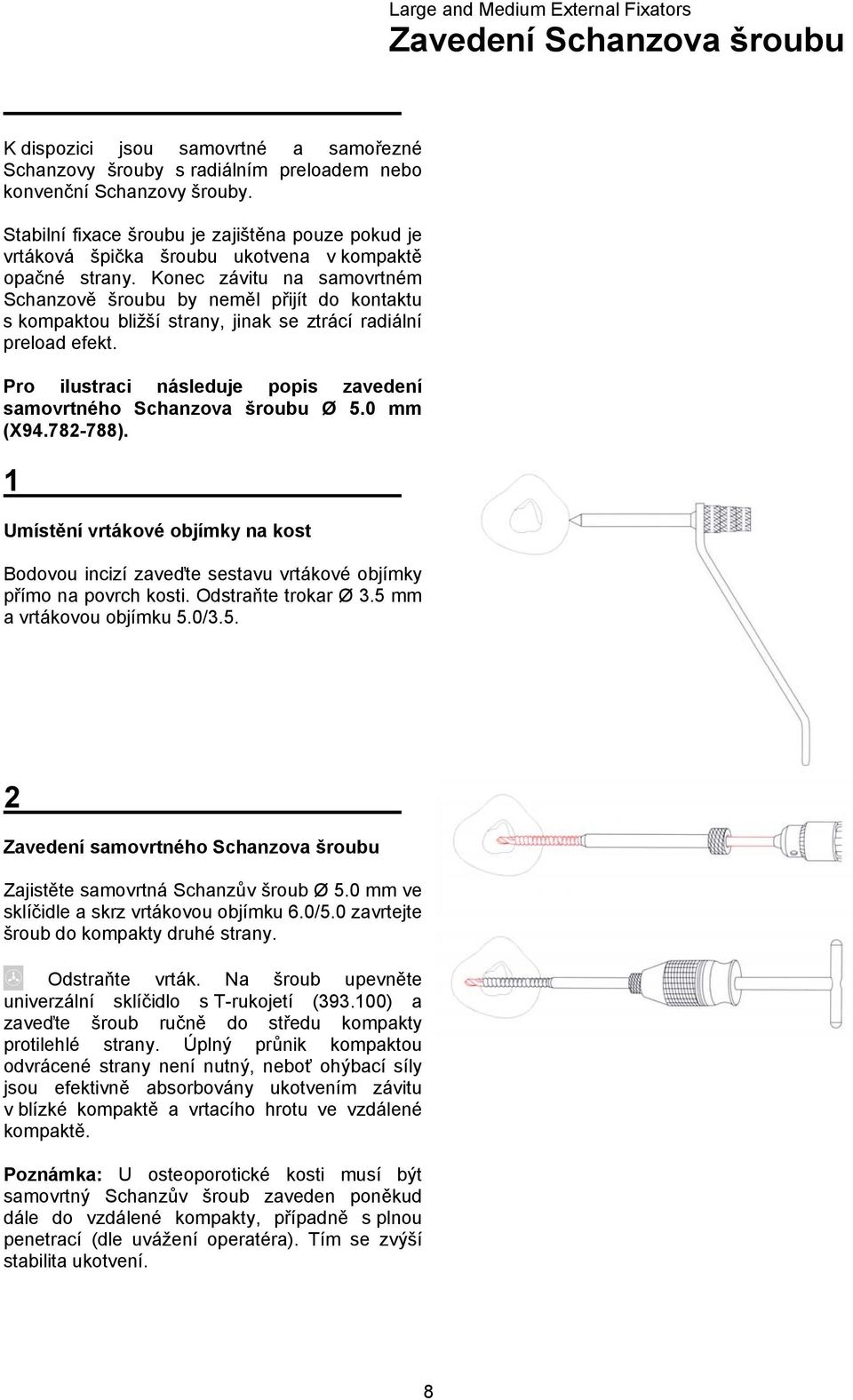 Konec závitu na samovrtném Schanzově šroubu by neměl přijít do kontaktu s kompaktou bližší strany, jinak se ztrácí radiální preload efekt.